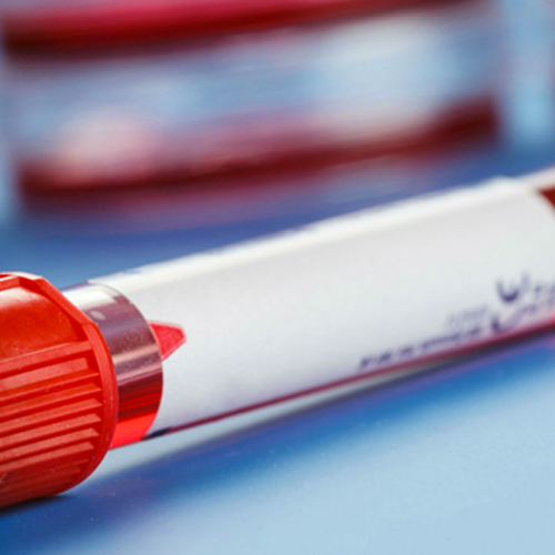 DONAZIONE DI PIASTRINE
